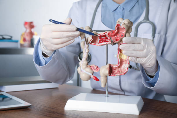 Gastrointestinal Surgeries